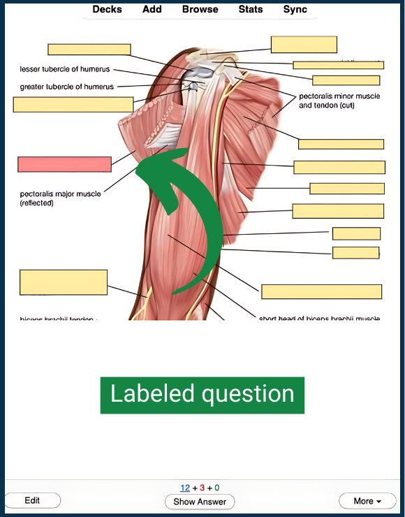 W/ Anki Image Occlusion cards, the red label acts as a prompt