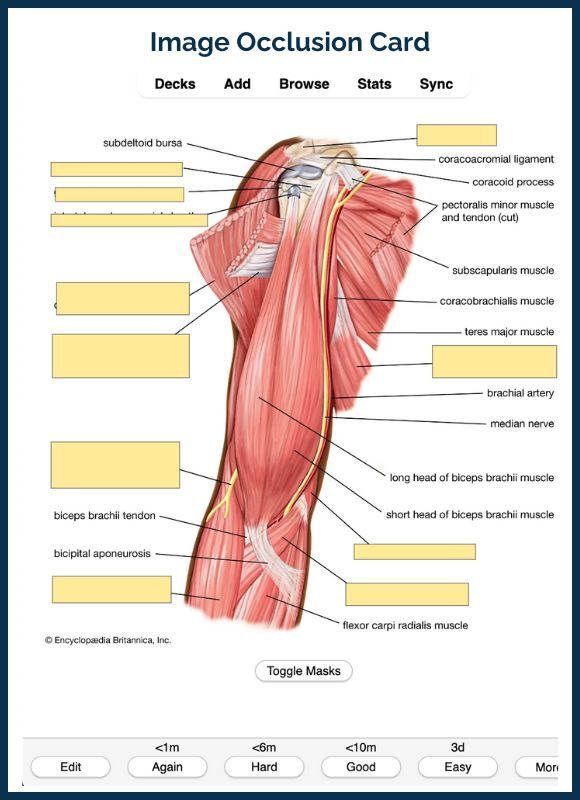 Example of an Anki Image Occlusion Card